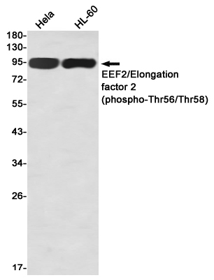 Phospho-Elongation Factor 2 (Thr56/Thr58) Rabbit mAb